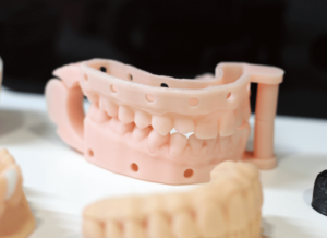 Impressão 3D